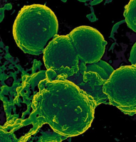 MRSA-Neutrophil_and_Methicillin-resistant_Staphylococccus_aureus_Bacteria-400x