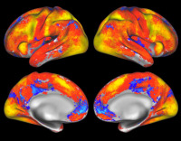 overall-4brains
