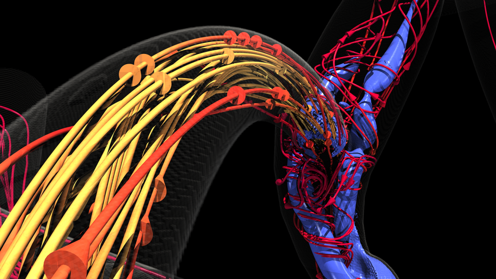Exascale Aurora System Will Visualize Spreading Cancer