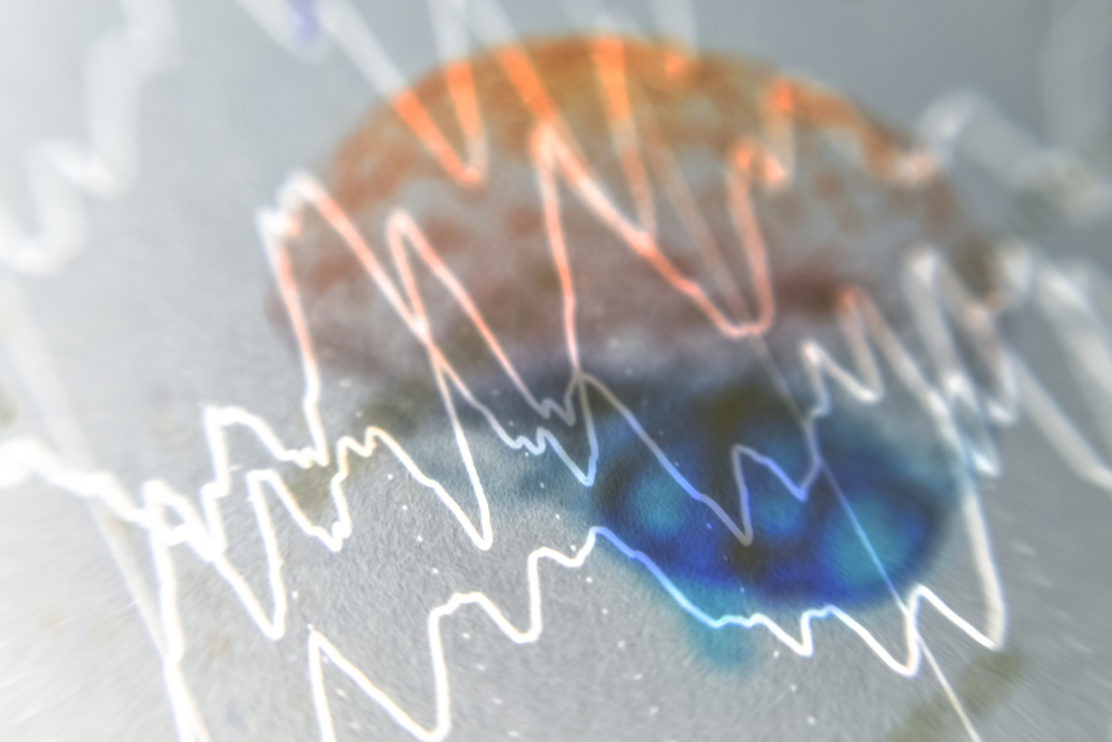 MIT Research Reveals AI May Be Dumbing Us Down